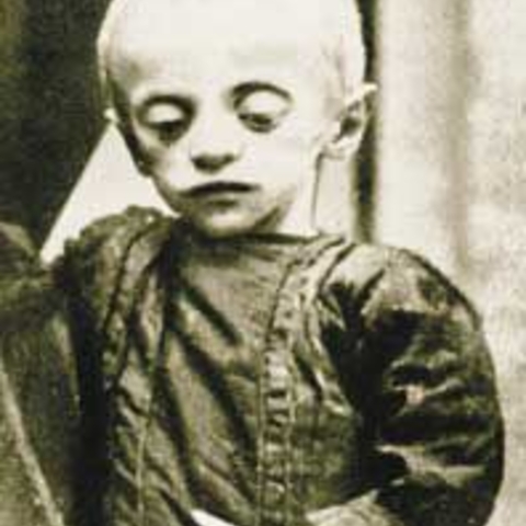 Child Victim of the Holodomor Famine in the Ukraine, 1933