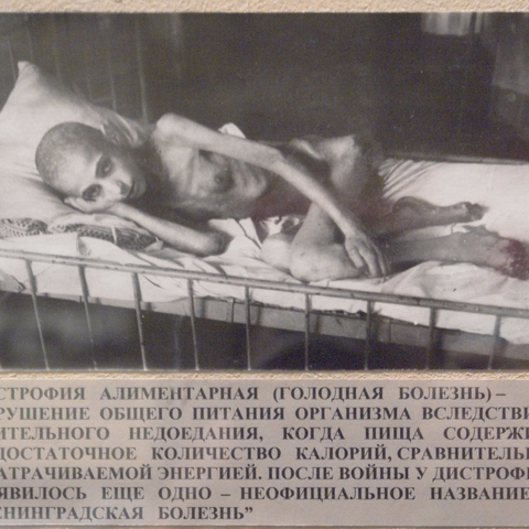 A picture of a starving woman from the Leningrad Blockade during World War II.