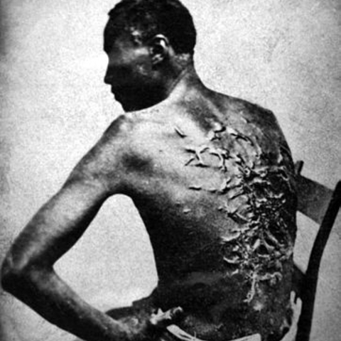 A Louisiana slave in 1863 with scars from numerous whippings.