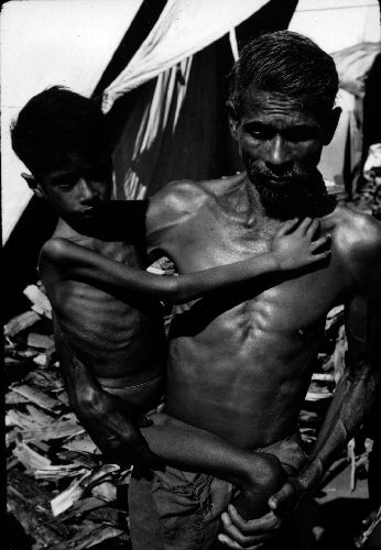 Images like these, of starving children and a malnourished population given to periodic famines, offer a human face to the long standing debate about whether India is "overpopulated" or "underdeveloped".