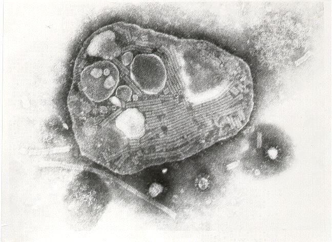 Microscopic view of the Rinderpest virus.