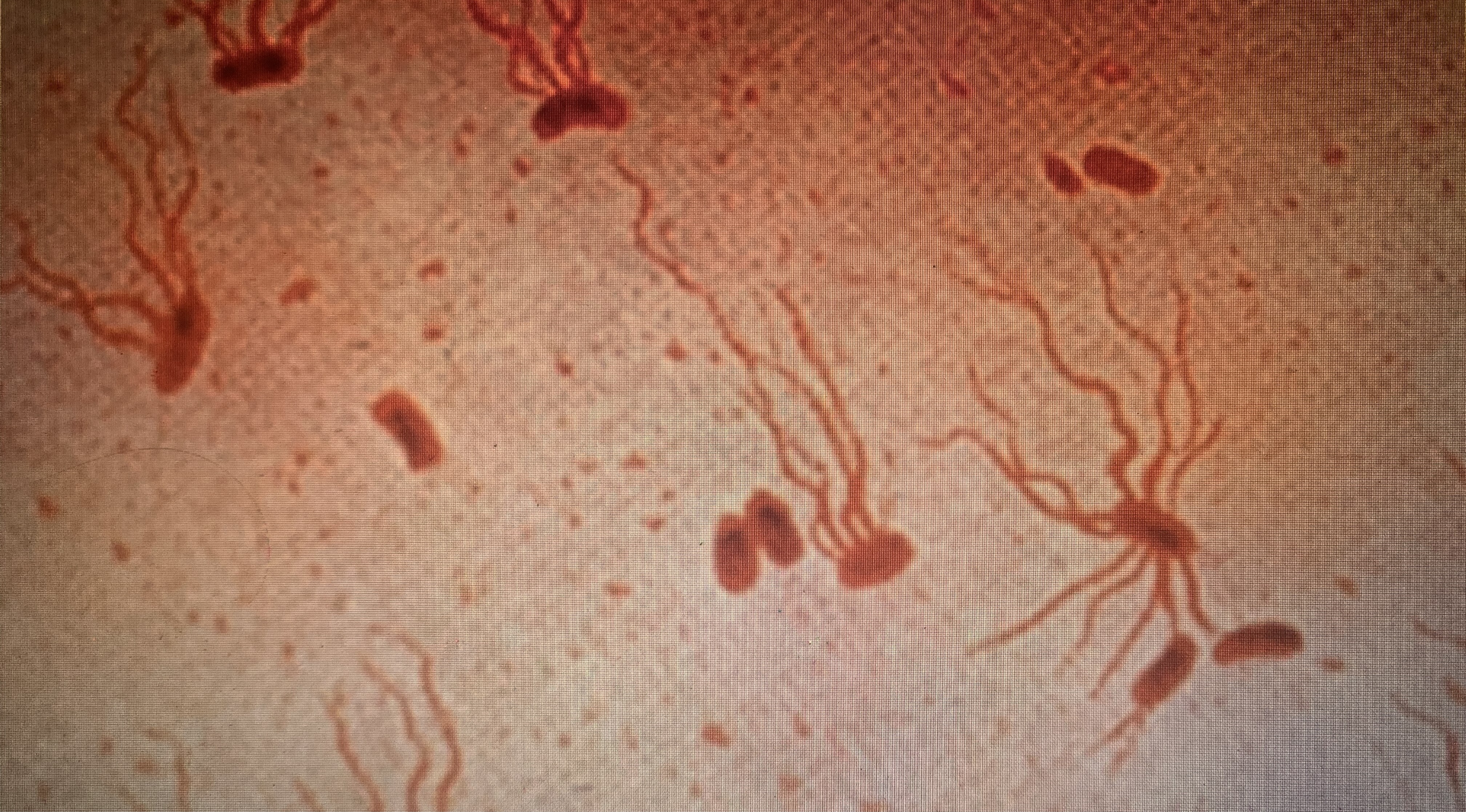 An image of Salmonella typhi captured on a microscope.