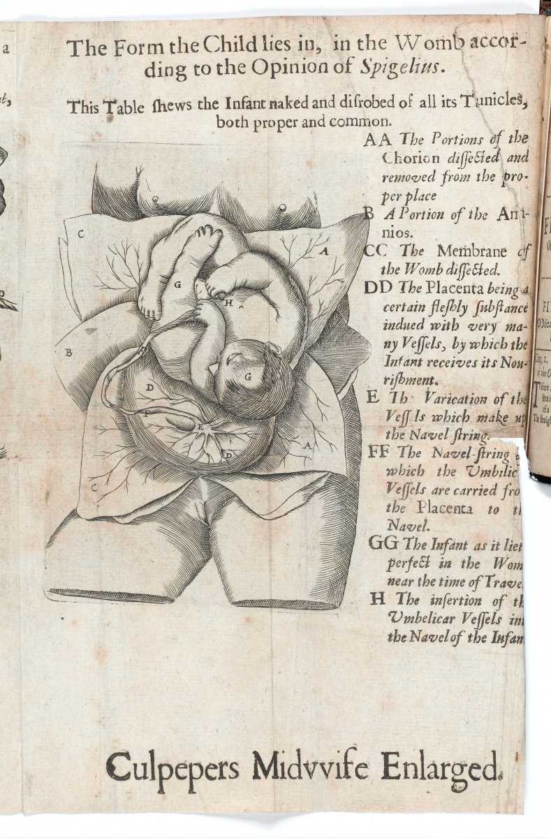 Image of a child in the womb from Culpeper's 'Directory for Midwives'