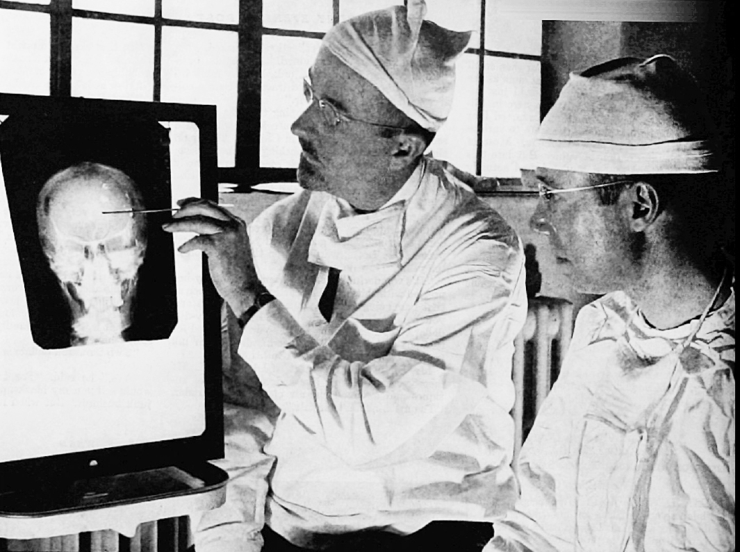 Doctors Walter Freeman (left) and James W. Watts (right) studying an X-ray before a psychosurgical operation