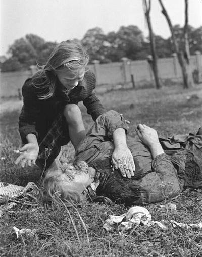 A Polish civilian injured by Luftwaffe.