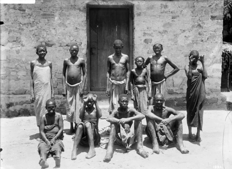 Paitents at the Bagamoyo Leprosy Home in Tanzania, circa 1906