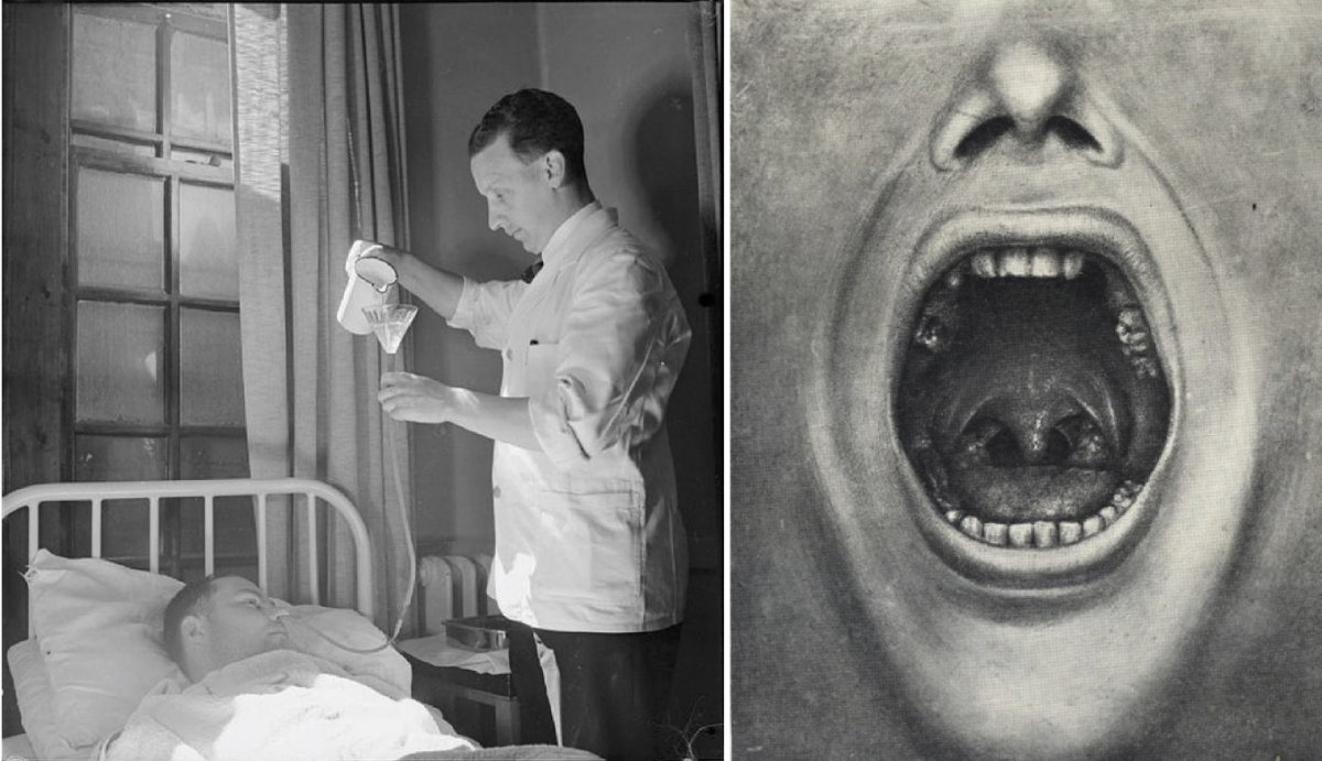 On the left, A nurse administering glucose to a patient receiving Insulin Shock Therapy in an Essex, England hospital in 1943. On the right, an image of removed teeth from Henry Cotton's 'The Defective Delinquent and Insane' (1921).