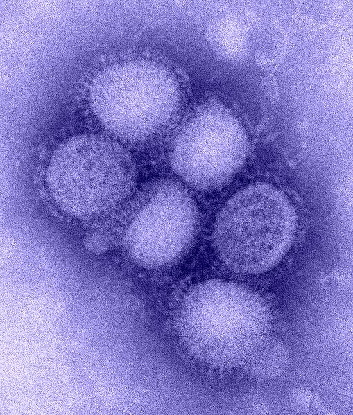 Influenza (H1N1) under the microscope.