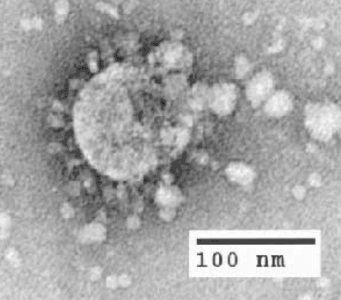 A microscopic image of SARS-CoV.