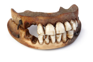 'Waterloo teeth' are denture sets.