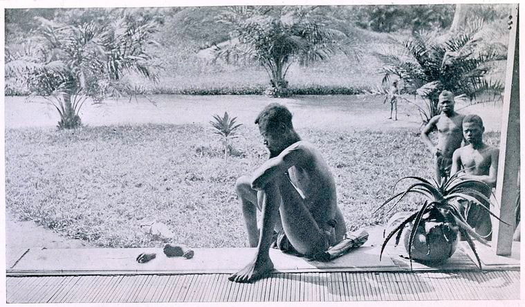 A Congolese man looks at the severed hand and foot of his five-year-old daughter who was killed by members of the Anglo-Belgian India Rubber Company militia in the Belgian colony of the Congo Free State, 1904