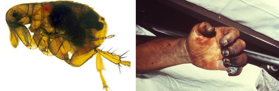 On the left, the oriental rat flea pictured is infected with the Yersinia pestis bacterium. On the right, a photo from a 1975 plague victim shows necrosis of the hand.