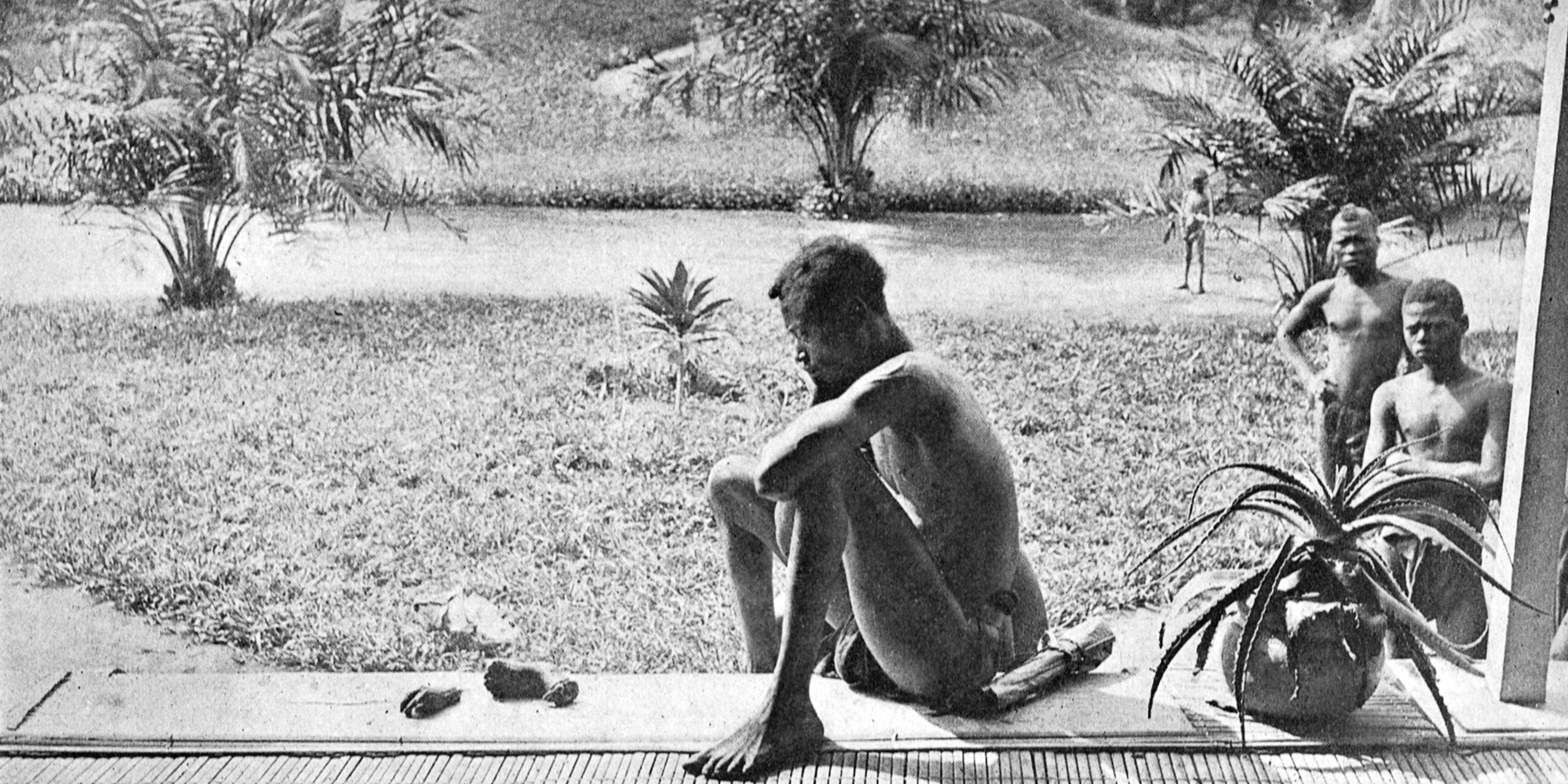 A Congolese man, Nsala, looking at the severed hand and foot of his five-year-old daughter who was killed, cooked, and cannibalized by members of the Force Publique in 1904.