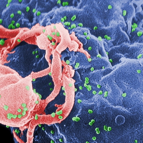 HIV-1 (in green) under a scanning electron micrograph.