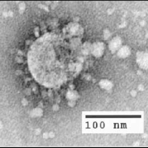An electron microscopic image of a thin section of SARS-CoV within the cytoplasm of an infected cell, showing the spherical particles and cross-sections through the viral nucleocapsid.