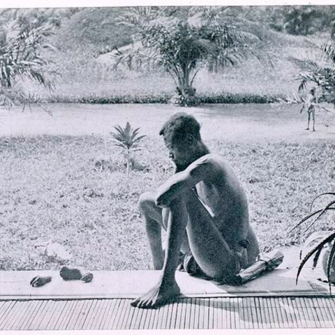 A photo taken by missionaries of a father who had brought his five-year-old daughter's severed foot and hand to them.